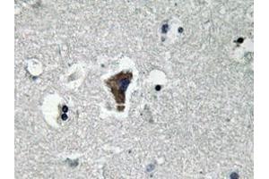 Immunohistochemistry analyzes of MyD88 antibody in paraffin-embedded human brain tissue. (MYD88 Antikörper)