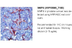 Image no. 2 for anti-Matrix Metallopeptidase 9 (Gelatinase B, 92kDa Gelatinase, 92kDa Type IV Collagenase) (MMP9) (N-Term) antibody (ABIN182741) (MMP 9 Antikörper  (N-Term))