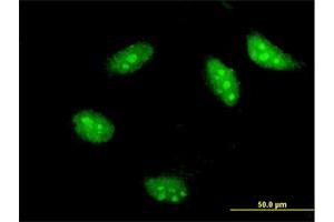 Immunofluorescence of monoclonal antibody to TWIST1 on HeLa cell. (TWIST1 Antikörper  (AA 100-202))