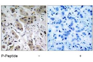Image no. 1 for anti-V-Akt Murine Thymoma Viral Oncogene Homolog 1 (AKT1) (pSer473) antibody (ABIN196708) (AKT1 Antikörper  (pSer473))