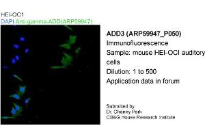 Image no. 1 for anti-Adducin 3 (Gamma) (ADD3) (Middle Region) antibody (ABIN2788273)