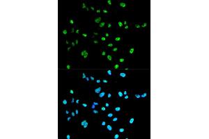 Immunofluorescence analysis of A549 cells using PAX2 antibody.