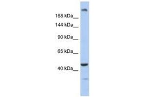 KIAA0284 Antikörper  (AA 551-600)