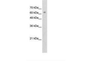 Image no. 2 for anti-Zinc Finger Protein 274 (ZNF274) (AA 87-136) antibody (ABIN203353)