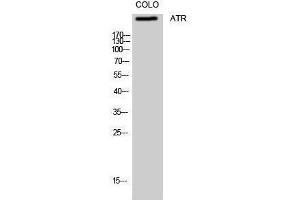 Western Blotting (WB) image for anti-ATR serine/threonine kinase (ATR) (Ser16) antibody (ABIN3183446) (ATR Antikörper  (Ser16))