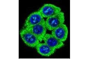 Immunofluorescence (IF) image for anti-Protein Associated with Topoisomerase II Homolog 2 (PATL2) (AA 165-196), (Middle Region) antibody (ABIN954004)