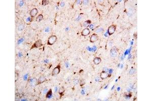 IHC-P: nNOS antibody testing of rat brain tissue (NOS1 Antikörper  (C-Term))