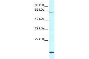 WB Suggested Anti-Dcaf11 Antibody   Titration: 1. (DCAF11 Antikörper  (C-Term))