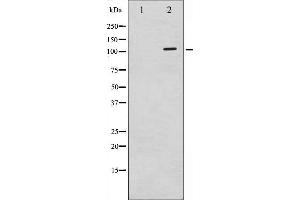 Western blot analysis of c-PLA2 phosphorylation expression in TNF-a treated HeLa whole cell lysates,The lane on the left is treated with the antigen-specific peptide. (PLA2G4A Antikörper  (pSer505))