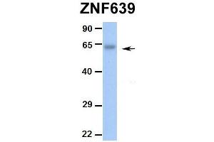 Hum. (ZNF639 Antikörper  (N-Term))