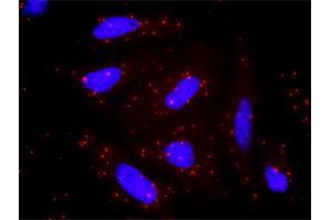 Proximity Ligation Assay (PLA) image for anti-Protein Phosphatase, Mg2+/Mn2+ Dependent, 1A (PPM1A) (AA 1-382) antibody (ABIN519084)