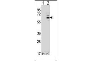 Western blot analysis of FASTK (arrow) using FAST kinase (C-term) Antibody (C-term) Cat. (FASTK Antikörper  (C-Term))