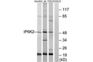 Western blot analysis of extracts from HuvEc/COLO/Jurkat cells, using IP6K2 Antibody.