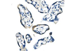 anti-Glycine Dehydrogenase (GLDC) (AA 574-1020) antibody