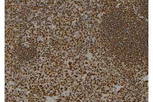 ABIN6262255 and ABIN6274017 at 1/100 staining Mouse spleen tissue by IHC-P.