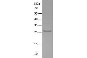 FGF3 Protein (AA 13-239) (His tag)