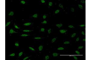 Immunofluorescence of monoclonal antibody to HMGXB4 on HeLa cell. (HMGXB4 Antikörper  (AA 1-74))