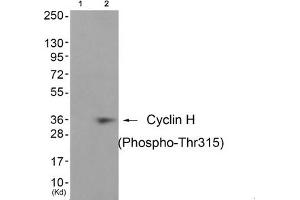 Western blot analysis of extracts from JK cells (Lane 2), using Cyclin H (Phospho-Thr315) Antibody. (Cyclin H Antikörper  (pThr315))