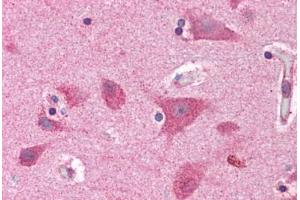 Immunohistochemistry (Formalin-fixed Paraffin-embedded Sections) (IHC (fp)) image for anti-Brain and Reproductive Organ-Expressed (TNFRSF1A Modulator) (BRE) (AA 9-338) antibody (ABIN604922)