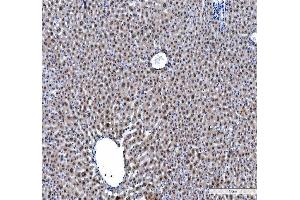 IHC analysis of hnRNP L/HNRNPL using anti-hnRNP L/HNRNPL antibody (ABIN7600130). (HNRNPL Antikörper  (AA 152-569))