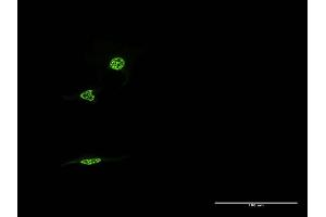 Immunofluorescence of monoclonal antibody to NR1D1 on HeLa cell.