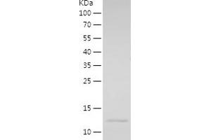 EVI2A Protein (AA 155-236) (His tag)