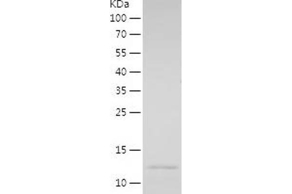 EVI2A Protein (AA 155-236) (His tag)