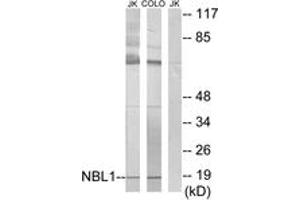 Western blot analysis of extracts from Jurkat/COLO cells, using NBL1 Antibody.