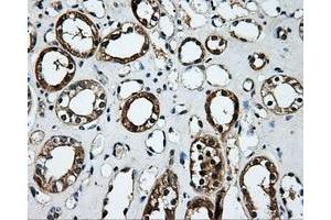 Immunohistochemical staining of paraffin-embedded Kidney tissue using anti-PLEKmouse monoclonal antibody. (Pleckstrin Antikörper)