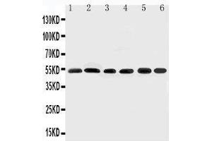 Anti-Smad2 antibody, Western blotting Lane 1: Rat Brain Tissue Lysate Lane 2: HELA Cell Lysate Lane 3: SMMC Cell Lysate Lane 4: JURKAT Cell Lysate Lane 5: U87 Cell Lysate Lane 6: MCF-7 Cell Lysate (SMAD2 Antikörper  (N-Term))
