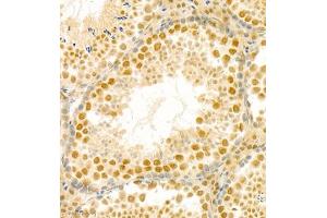 Immunohistochemistry (Paraffin-embedded Sections) (IHC (p)) image for anti-PHD Finger Protein 10 (PHF10) antibody (ABIN7075029)