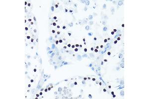 Immunohistochemistry (IHC) image for anti-Histone H2A (pSer139) antibody (ABIN6136140)
