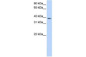 WB Suggested Anti-NCF4 Antibody Titration:  0. (NCF4 Antikörper  (Middle Region))
