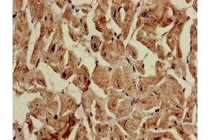 Immunohistochemistry of paraffin-embedded human heart tissue using ABIN7149026 at dilution of 1:100
