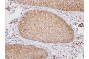 Immunohistochemistry (IHC) image for anti-Prostaglandin F2 Receptor Negative Regulator (PTGFRN) (C-Term) antibody (ABIN2856576)
