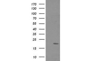 Image no. 2 for anti-Fetal and Adult Testis Expressed 1 (FATE1) antibody (ABIN1498224) (FATE1 Antikörper)