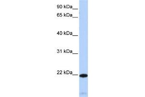 WB Suggested Anti-RGS5 Antibody Titration:  0. (RGS5 Antikörper  (Middle Region))