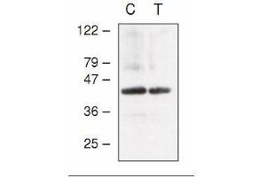Western blot analysis of Arabidopsis chloroplast (C) and thylakoid (T) proteins with anti-CF1gamma (AtpC).