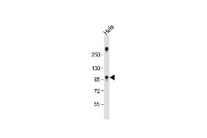 Anti-ZCCHC14 Antibody (Center) at 1:1000 dilution + Hela whole cell lysate Lysates/proteins at 20 μg per lane. (ZCCHC14 Antikörper  (AA 420-449))