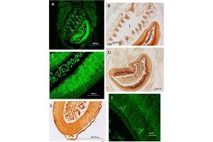 Immunohistochemistry results using Anti-Carbonic Anhydrase II (RABBIT) Antibody. (CA2 Antikörper)