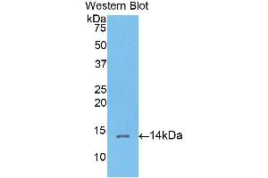 Western Blotting (WB) image for anti-Corin, Serine Peptidase (CORIN) (AA 533-634) antibody (ABIN3203375) (Corin Antikörper  (AA 533-634))