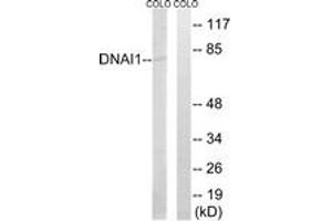 Western blot analysis of extracts from COLO cells, using DNAI1 Antibody. (DNAI1 Antikörper  (AA 211-260))