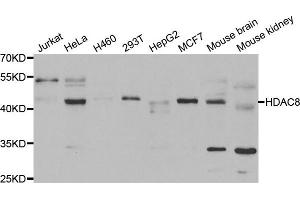Western blot analysis of extracts of various cell lines, using HDAC8 antibody.