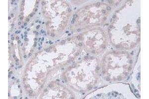 IHC-P analysis of Human Kidney Tissue, with DAB staining. (CPA4 Antikörper  (AA 55-421))