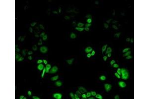 Detection of Hsp27 in Human Hela Cell using Polyclonal Antibody to Heat Shock Protein 27 (Hsp27) (HSP27 Antikörper  (AA 1-201))