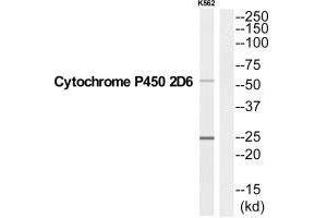 Western blot analysis of extracts from K562 cells, using CYP2D6 antibody. (CYP2D6 Antikörper  (C-Term))
