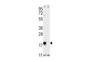 Western blot analysis of anti-THY1 (N-term) Pab (ABIN388803 and ABIN2839126) pre-incubated without(lane 1) and with(lane 2) blocking peptide (BP2050a) in T47D cell line lysate. (CD90 Antikörper  (N-Term))