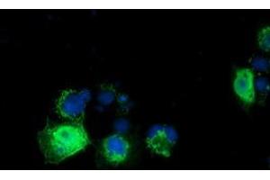 Anti-RASD2 mouse monoclonal antibody (ABIN2453586) immunofluorescent staining of COS7 cells transiently transfected by pCMV6-ENTRY RASD2 (RC201454). (RASD2 Antikörper)