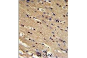 Immunohistochemistry (Paraffin-embedded Sections) (IHC (p)) image for anti-Tumor Protein P73 (TP73) (AA 288-317) antibody (ABIN652829)