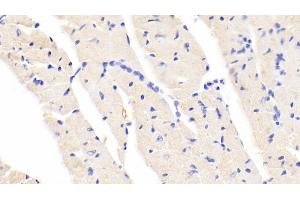 Detection of BACE2 in Mouse Cardiac Muscle Tissue using Polyclonal Antibody to Beta Secretase 2 (BACE2) (BACE2 Antikörper  (AA 156-407))